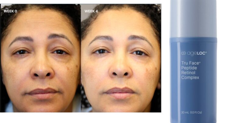 ageloc skin complex